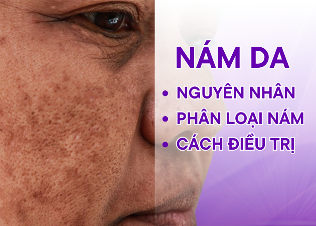 Nám khiến chị em già nua đi trông thấy